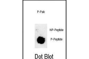 Dot blot analysis of anti-phospho-Sox2-p Phospho-specific Pab (ABIN650879 and ABIN2839822) on nitrocellulose membrane. (SOX2 Antikörper  (pSer251))
