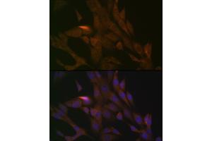 Immunofluorescence analysis of NIH-3T3 cells using PER3 Rabbit mAb (ABIN7269225) at dilution of 1:100 (40x lens). (PER3 Antikörper)