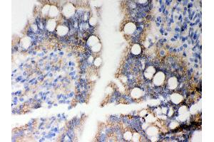 Immunohistochemistry (IHC) image for anti-Major Histocompatibility Complex, Class I, A (HLA-A) (AA 82-106), (N-Term) antibody (ABIN3043842)