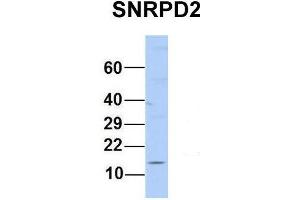 Host:  Rabbit  Target Name:  SNRPD2  Sample Type:  Human MCF7  Antibody Dilution:  1. (SNRPD2 Antikörper  (N-Term))