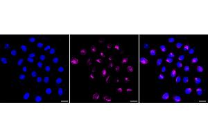Immunocytochemical staining of HepG2 cells with NDC80 antibody (ABIN7799564), 1:1,000). (Rekombinanter NDC80 Antikörper)