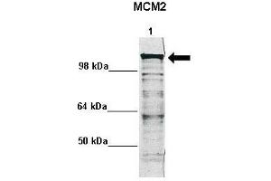 WB Suggested Anti-MCM2 Antibody    Positive Control:  Lane 1: 5ug mouse neural stem cell lysate  Primary Antibody Dilution :   1:1000  Secondary Antibody :  Anti rabbit - IR-dye  Secondry Antibody Dilution :   1:10,000   Submitted by:  Anonymous (MCM2 Antikörper  (N-Term))