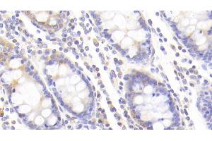Immunohistochemistry (IHC) image for anti-Mannose Phosphate Isomerase (MPI) (AA 2-423) antibody (ABIN7441487)