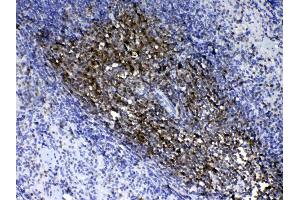 Immunohistochemistry (IHC) image for anti-CD90 (THY1) (AA 20-131) antibody (ABIN5518877)