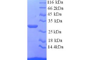 SDS-PAGE (SDS) image for Asialoglycoprotein Receptor 1 (ASGR1) (AA 61-284) protein (His tag) (ABIN5713264) (Asialoglycoprotein Receptor 1 Protein (ASGR1) (AA 61-284) (His tag))