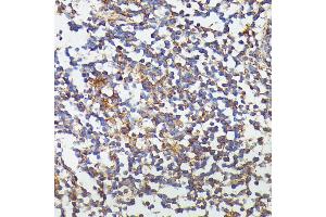 Immunohistochemistry of paraffin-embedded human colon using CSF3 antibody (ABIN6127710, ABIN6139100, ABIN6139101 and ABIN6221772) at dilution of 1:100 (40x lens). (G-CSF Antikörper  (AA 30-207))