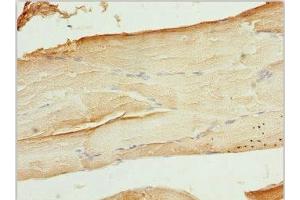 Immunohistochemistry of paraffin-embedded human skeletal muscle tissue using ABIN7175708 at dilution of 1:100 (WIPI2 Antikörper  (AA 205-454))