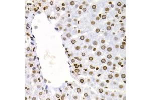 Immunohistochemistry of paraffin-embedded rat liver using NFKB2 Antibody (ABIN5971590) at dilution of 1/100 (40x lens). (NFKB2 Antikörper)