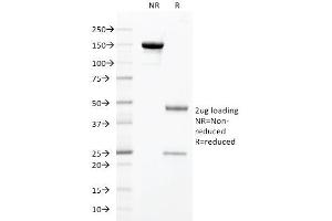 SDS-PAGE Analysis Purified HNF1A Mouse Monoclonal Antibody (HNF1A/2087). (HNF1A Antikörper  (AA 214-339))