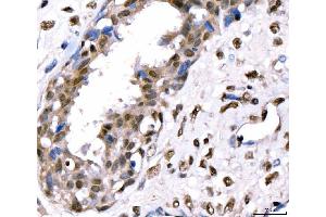 IHC analysis of CRTC3 using anti-CRTC3 antibody (ABIN7599779). (CRTC3 Antikörper  (AA 116-619))