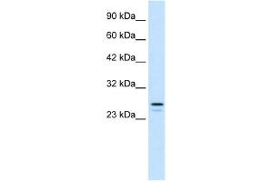 WB Suggested Anti-RNF2 Antibody Titration:  1. (RNF2 Antikörper  (Middle Region))