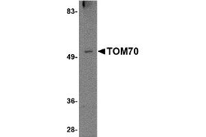 Western Blotting (WB) image for anti-Translocase of Outer Mitochondrial Membrane 70 (TOMM70A) (N-Term) antibody (ABIN1031635) (TOM70 Antikörper  (N-Term))