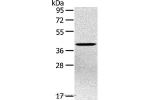 Western blot analysis of Hepg2 cell, using PTX3 Polyclonal Antibody at dilution of 1:400 (PTX3 Antikörper)