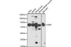 Western blot analysis of extracts of various cell lines, using YARS antibody (ABIN6128883, ABIN6150324, ABIN6150325 and ABIN6222537) at 1:1000 dilution. (YARS Antikörper  (AA 1-300))