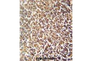 Immunohistochemistry (IHC) image for anti-Zinc Finger Protein 98 (ZNF98) antibody (ABIN5015331) (ZNF98 Antikörper)