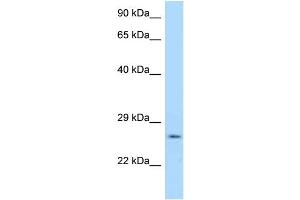 WB Suggested Anti-Ywhag Antibody Titration: 1. (14-3-3 gamma Antikörper  (N-Term))