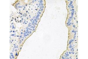 Immunohistochemistry of paraffin-embedded Mouse lung using HPR Polyclonal Antibody at dilution of 1:100 (40x lens). (HPR Antikörper)