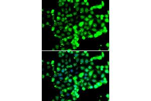 Immunofluorescence analysis of U20S cell using FASTK antibody. (FASTK Antikörper)