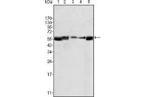 Western blot analysis using LYN mouse mAb agains HL60 (1), L540 (2), SLLP-M2 (3), SEM (4) and Ramos (5) cell lysate. (LYN Antikörper)