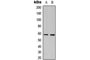 Western blot analysis of Estrogen Receptor 2 expression in COLO205 (A), NIH3T3 (B) whole cell lysates. (ESR2 Antikörper  (Center))