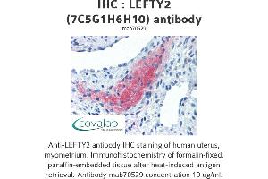Image no. 1 for anti-Left-Right Determination Factor 2 (LEFTY2) antibody (ABIN1723390) (LEFTY2 Antikörper)