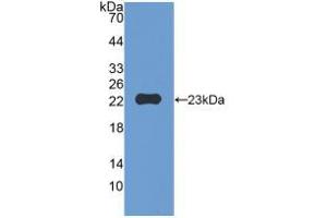 Western blot analysis of recombinant Mouse MMP12. (MMP12 Antikörper  (AA 294-473))