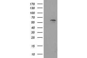 Western Blotting (WB) image for anti-Exonuclease 3'-5' Domain Containing 1 (EXD1) antibody (ABIN1498134) (EXD1 Antikörper)