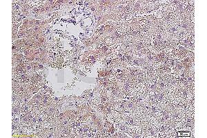 Formalin-fixed and paraffin embedded rat liver tissue with Anti-Resistin Polyclonal Antibody, Unconjugated (ABIN728278) at 1:400, followed by conjugation to the secondary antibody and DAB staining