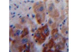 IHC-P analysis of Liver tissue, with DAB staining. (A1BG Antikörper  (AA 313-512))