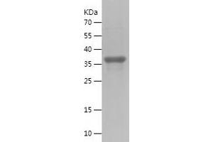 Western Blotting (WB) image for Interleukin 23, alpha subunit p19 (IL23A) (AA 20-157) protein (His-IF2DI Tag) (ABIN7123578) (IL23A Protein (AA 20-157) (His-IF2DI Tag))