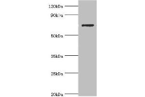 Western blot All lanes: SLC25A13 antibody at 3 μg/mL + HepG2 whole cell lysate Secondary Goat polyclonal to rabbit IgG at 1/10000 dilution Predicted band size: 74 kDa Observed band size: 74 kDa (slc25a13 Antikörper  (AA 1-300))