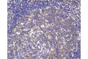 Immunohistochemistry analysis of paraffin-embedded rat lymph using CD284 Polyclonal Antibody at dilution of 1:1000. (TLR4 Antikörper)