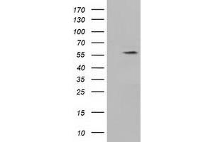 HEK293T cells were transfected with the pCMV6-ENTRY control (Left lane) or pCMV6-ENTRY KLHL2 (Right lane) cDNA for 48 hrs and lysed. (KLHL2 Antikörper  (AA 1-100, AA 494-593))