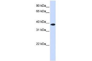 WB Suggested Anti-GPD1L Antibody Titration: 0. (GPD1L Antikörper  (Middle Region))