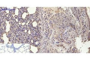 Immunohistochemistry of paraffin-embedded Rat lung tissue using BMP2 Polyclonal Antibody at dilution of 1:200. (BMP2 Antikörper)
