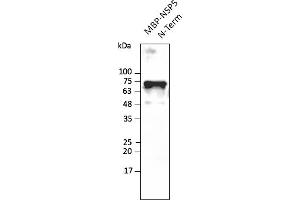 Western Blotting (WB) image for anti-SARS-CoV-2 3C-Like Proteinase (NSP5) (3CL-PRO, M-Pro) (N-Term) antibody (ABIN7273000) (SARS-CoV-2 NSP5 (3CL-Pro) Antikörper  (N-Term))
