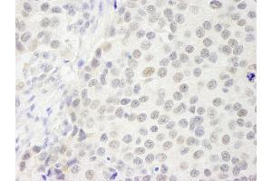 Immunohistochemistry (IHC) image for anti-GATA Zinc Finger Domain Containing 2B (GATAD2B) (AA 50-100) antibody (ABIN7448709) (GATAD2B Antikörper  (AA 50-100))
