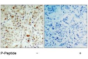 Image no. 2 for anti-Retinoblastoma 1 (RB1) (pSer807) antibody (ABIN196840) (Retinoblastoma 1 Antikörper  (pSer807))