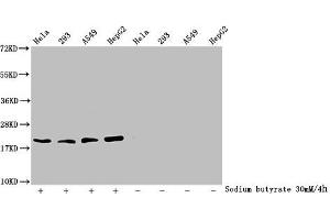 Western Blot Detected samples: Hela whole cell lysate, 293 whole cell lysate, A549 whole cell lysate, HepG2 whole cell lysate, Untreated (-) or treated (+) with 30 mM sodium butyrate for 4h All lanes: HIST1H1C antibody at 2. (HIST1H1C Antikörper  (acLys84))