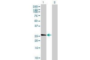 Western Blotting (WB) image for FIGLA 293T Cell Transient Overexpression Lysate(Denatured) (ABIN1339358)