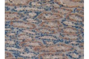 DAB staining on IHC-P; Samples: Human Kidney Tissue (MUC1 Antikörper  (AA 1098-1255))