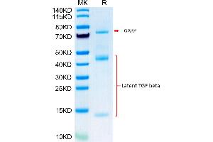 Biotinylated Mouse GARP&Latent TGF beta Complex on Tris-Bis PAGE under reduced condition.