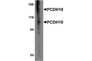 Western Blotting (WB) image for anti-Protocadherin 18 (PCDH18) (N-Term) antibody (ABIN1031506) (PCDH18 Antikörper  (N-Term))