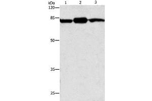 Western Blot analysis of Mouse brain and skin tissue, 293T cell using CAPN2 Polyclonal Antibody at dilution of 1:200 (Calpain 2 Antikörper)