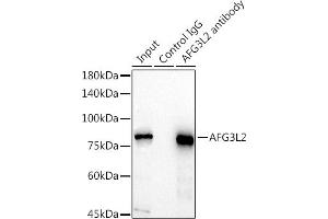 Immunoprecipitation analysis of 300 μg extracts of HeLa cells using 3 μg L2 antibody (ABIN7265513). (AFG3L2 Antikörper  (AA 538-797))