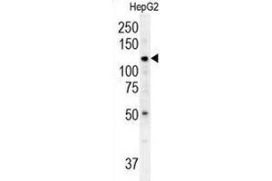 Western Blotting (WB) image for anti-ATPase Type 13A3 (ATP13A3) antibody (ABIN3002493) (ATP13A3 Antikörper)