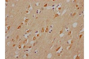 IHC image of ABIN7127632 diluted at 1:100 and staining in paraffin-embedded human brain tissue performed on a Leica BondTM system. (Rekombinanter CHRM3 Antikörper)