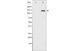Western blot analysis of Calcium Sensing Receptor expression in LOVO whole cell lysates,The lane on the left is treated with the antigen-specific peptide. (CASR Antikörper  (C-Term))