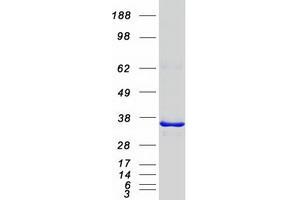 Western Blotting (WB) image for Phosphotidylinositol Transfer Protein, beta (PITPNB) protein (Myc-DYKDDDDK Tag) (ABIN2729023)