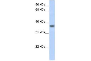 TMEM173 antibody used at 1 ug/ml to detect target protein. (STING/TMEM173 Antikörper  (Middle Region))